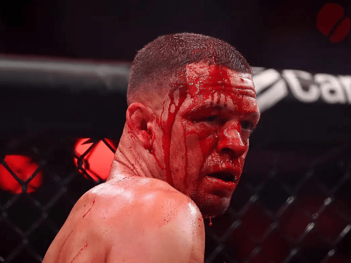 Brutális sérülések és hosszú eltiltások az MVP MMA 1 után: Nate Diaz súlyos árat fizetett Mike Perry ellen