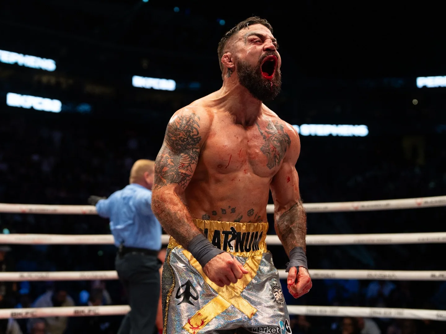 David Feldman reagált Mike Perry döntésére: továbbra is tervben van a Darren Till elleni BKFC-meccs